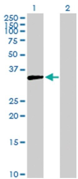 aldo-keto reductase family 1, member D1 (delta 4-3-ketosteroid-5-beta-reductase),