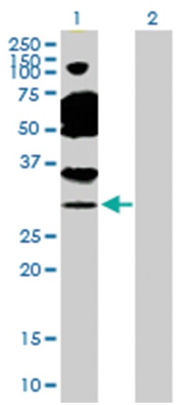 TAF11 RNA polymerase II, TATA box binding protein (TBP)-associated factor,
