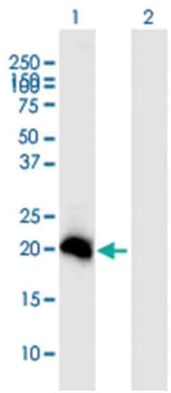 anti-HEMK2, Polyclonal, Abnova 50&mu;g, Unlabeled:Antibodies, Polyclonal