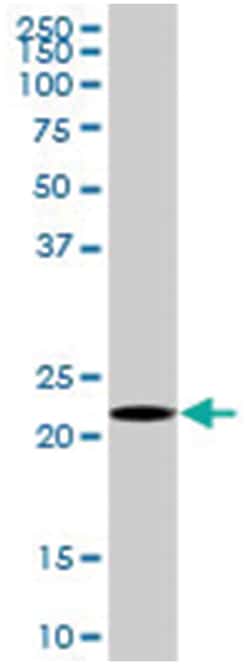 anti-HEMK2, Polyclonal, Abnova 50&mu;g, Unlabeled:Antibodies, Polyclonal