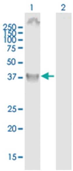 anti-TSP50, Polyclonal, Abnova 50&mu;g, Unlabeled:Antibodies, Polyclonal
