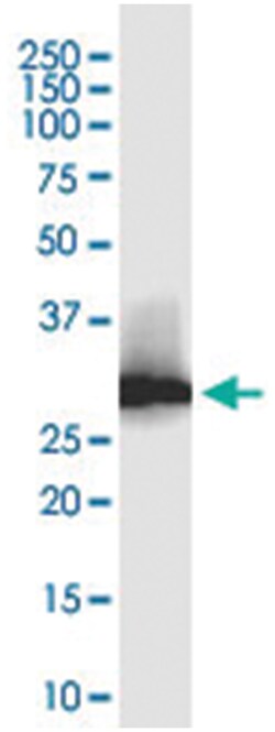 anti-LACTB2, Clone: 1H3, Abnova 100 &mu;g | Buy Online | Abnova Corporation | Fisher Scientific