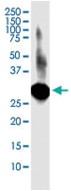 anti-LACTB2, Clone: 1H3, Abnova 100 &mu;g | Buy Online | Abnova Corporation | Fisher Scientific