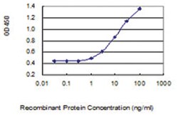 anti-LACTB2, Clone: 1H3, Abnova 100 &mu;g | Buy Online | Abnova Corporation | Fisher Scientific