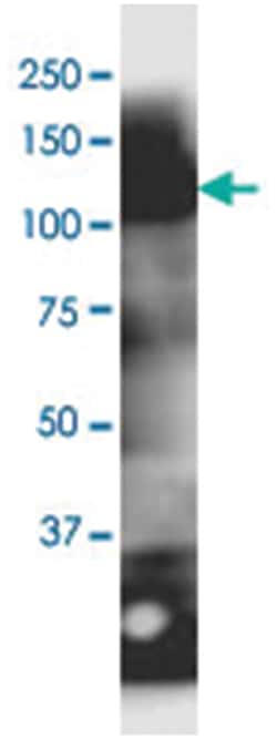 anti-MOCOS, Clone: 2E8., Abnova 100&mu;g, Unlabeled:Antibodies, Monoclonal