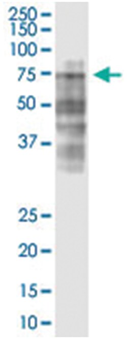 anti-LRRC40, Clone: 3E10., Abnova 100 &mu;g | Buy Online | Abnova Corporation | Fisher Scientific