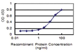 anti-KIAA1217, Clone: 3B10, Abnova 100 &mu;g | Buy Online | Abnova Corporation | Fisher Scientific
