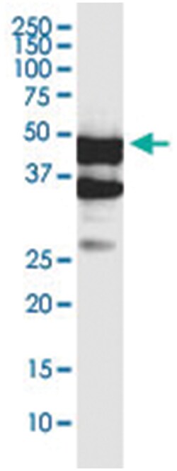 anti-SERTAD4, Clone: 3G11, Abnova 100 &mu;g | Buy Online | Abnova Corporation | Fisher Scientific