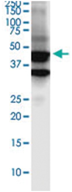 anti-SERTAD4, Clone: 3G11, Abnova 100 &mu;g | Buy Online | Abnova Corporation | Fisher Scientific