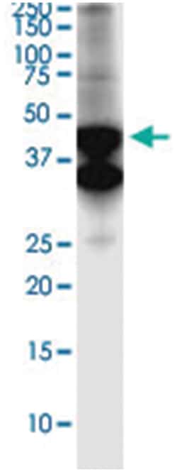 anti-SERTAD4, Clone: 3G11, Abnova 100 &mu;g | Buy Online | Abnova Corporation | Fisher Scientific