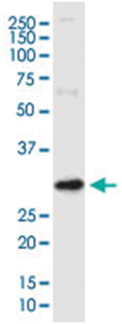 anti-ARV1, Clone: 4G12, Abnova 100 &mu;g | Buy Online | Abnova Corporation | Fisher Scientific