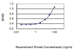 anti-ARV1, Clone: 4G12, Abnova 100 &mu;g | Buy Online | Abnova Corporation | Fisher Scientific