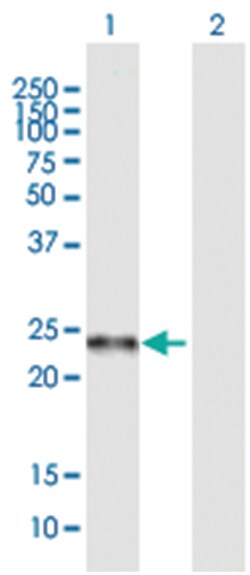anti-C19orf50, Polyclonal, Abnova 50 &mu;g | Buy Online | Abnova Corporation | Fisher Scientific
