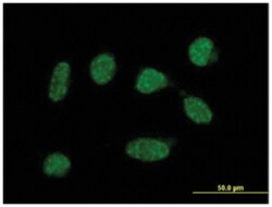 anti-C19orf50, Polyclonal, Abnova 50 &mu;g | Buy Online | Abnova Corporation | Fisher Scientific