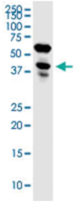 anti-LENG1, Clone: 2E7., Abnova 100 &mu;g | Buy Online | Abnova Corporation | Fisher Scientific