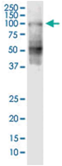 anti-SHCBP1, Clone: 1G8, Abnova 100 &mu;g | Buy Online | Abnova Corporation | Fisher Scientific