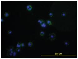 CD276 (28-238) Mouse anti-Human, Clone: 7G6, Abnova 100&mu;g; Unlabeled:Antibodies,