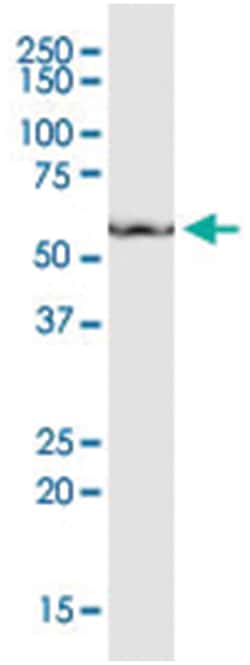 anti-CD276, Clone: 1A6, Abnova 100 &mu;g | Buy Online | Abnova Corporation | Fisher Scientific
