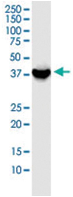 anti-GSG1, Clone: 1D11, Abnova 100 &mu;g | Buy Online | Abnova Corporation | Fisher Scientific