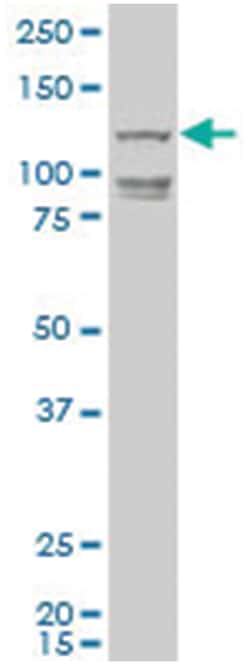 DNA helicase HEL308 (A01), Mouse anti-Human, Polyclonal Antibody, Abnova 50 &mu;L | Buy Online | Abnova | Fisher Scientific