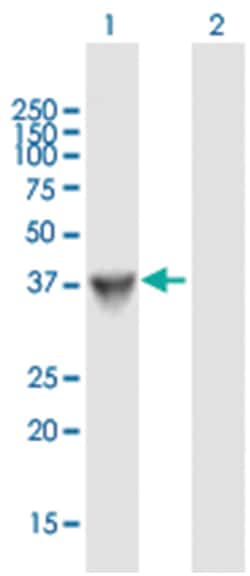 serine dehydratase-like, Mouse, Polyclonal Antibody, Abnova 50&mu;L; Unlabeled:Antibodies,