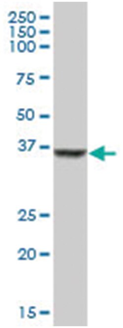 serine dehydratase-like, Mouse, Polyclonal Antibody, Abnova 50&mu;L; Unlabeled:Antibodies,