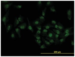 target of EGR1, member 1 (nuclear), Mouse, Clone: 1C12, Abnova 100&mu;g;