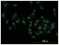 target of EGR1, member 1 (nuclear), Mouse, Clone: 1C12, Abnova 100&mu;g;