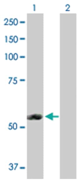 erythroblast membrane-associated protein (Scianna blood group), Rabbit,