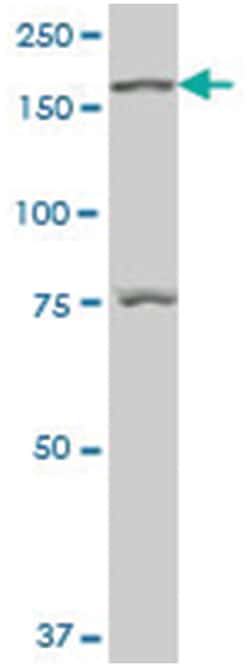 lemur tyrosine kinase 3, Mouse, Polyclonal Antibody, Abnova 50&mu;L; Unlabeled:Antibodies,