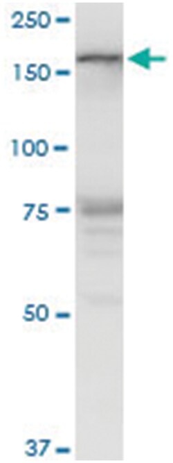 lemur tyrosine kinase 3, Mouse, Polyclonal Antibody, Abnova 50&mu;L; Unlabeled:Antibodies,