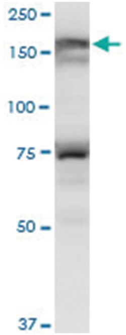 lemur tyrosine kinase 3, Mouse, Polyclonal Antibody, Abnova 50&mu;L; Unlabeled:Antibodies,
