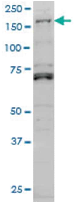 LMTK3, Mouse, Clone: 2H6, Abnova 200&mu;L; Unlabeled:Antibodies, Monoclonal