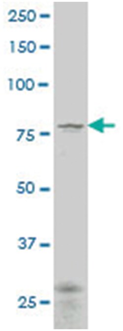 transglutaminase 7, Mouse, Polyclonal Antibody, Abnova 50 &mu;L | Buy Online | Abnova Corporation | Fisher Scientific