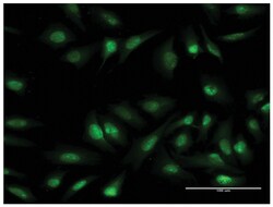 oligodendrocyte transcription factor 1, Mouse, Clone: 2B11, Abnova 100&mu;g;