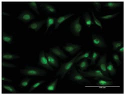 oligodendrocyte transcription factor 1, Mouse, Clone: 2B11, Abnova 100&mu;g;