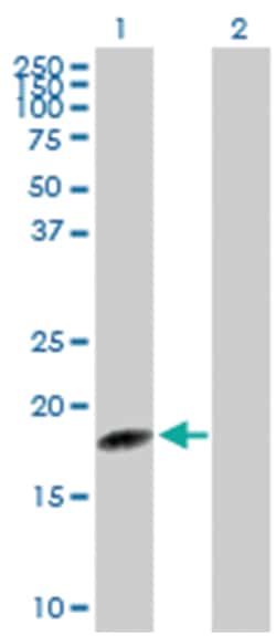 tRNA splicing endonuclease 15 homolog (S. cerevisiae), Rabbit, Purified
