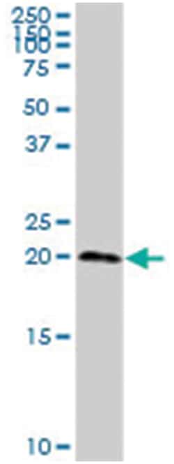 tRNA splicing endonuclease 15 homolog (S. cerevisiae), Rabbit, Purified