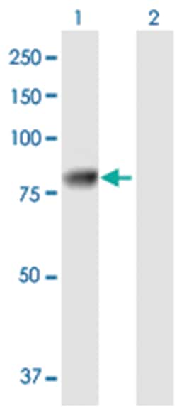 synovial sarcoma, X breakpoint 2 interacting protein, Mouse, Polyclonal