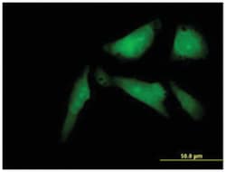 synovial sarcoma, X breakpoint 2 interacting protein, Mouse, Polyclonal