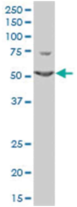 tripartite motif-containing 6, Mouse, Polyclonal Antibody, Abnova 50μL;