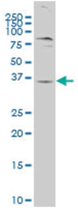 G protein-coupled receptor 62, Mouse, Polyclonal Antibody, Abnova 50&mu;L;