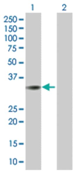 sideroflexin 2, Mouse, Polyclonal Antibody, Abnova 50 &mu;L | Buy Online | Abnova Corporation | Fisher Scientific