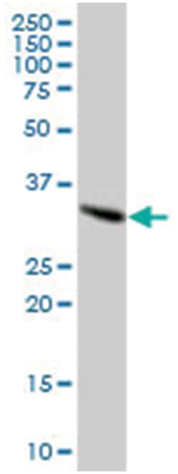 sideroflexin 2, Mouse, Polyclonal Antibody, Abnova 50 &mu;L | Buy Online | Abnova Corporation | Fisher Scientific