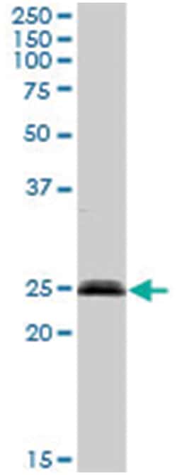 SUMO/sentrin specific peptidase family member 8, Rabbit, Purified MaxPab