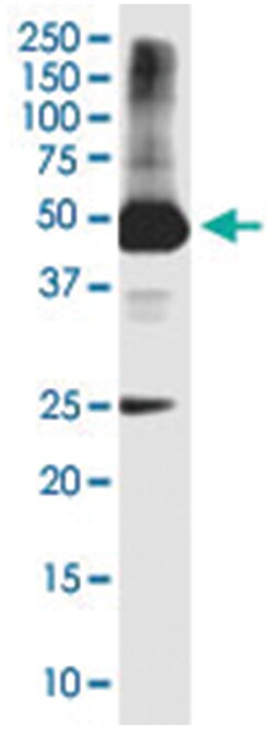 HYKK, Mouse, Clone: 4F2, Abnova 100&mu;g; Unlabeled:Antibodies, Monoclonal