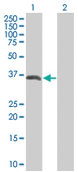 musashi homolog 2 (Drosophila), Mouse, Polyclonal Antibody, Abnova 50&mu;L;