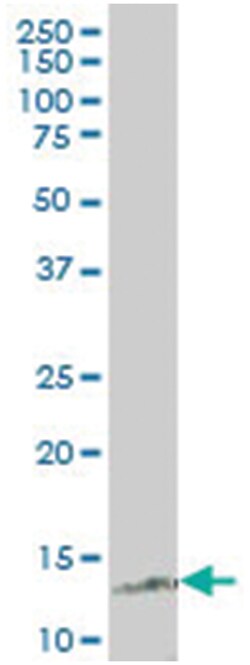 nuclear receptor 2C2-associated protein, Mouse, Polyclonal Antibody, Abnova