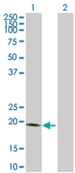 V-set and transmembrane domain containing 2 like, Rabbit, Purified MaxPab