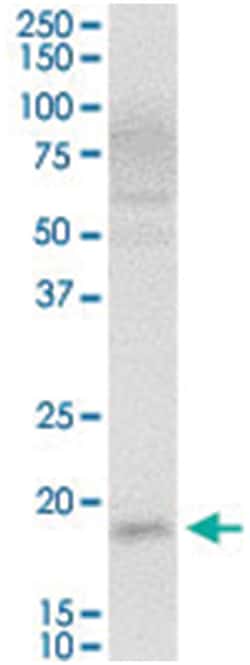 V-set and transmembrane domain containing 2 like, Rabbit, Purified MaxPab